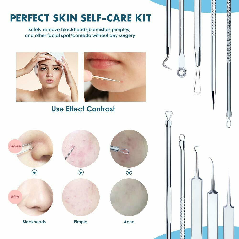 8pcs Blackhead Remover Tool Pimple Popper Pore Blemish Comedone Acne Cleaner Kit