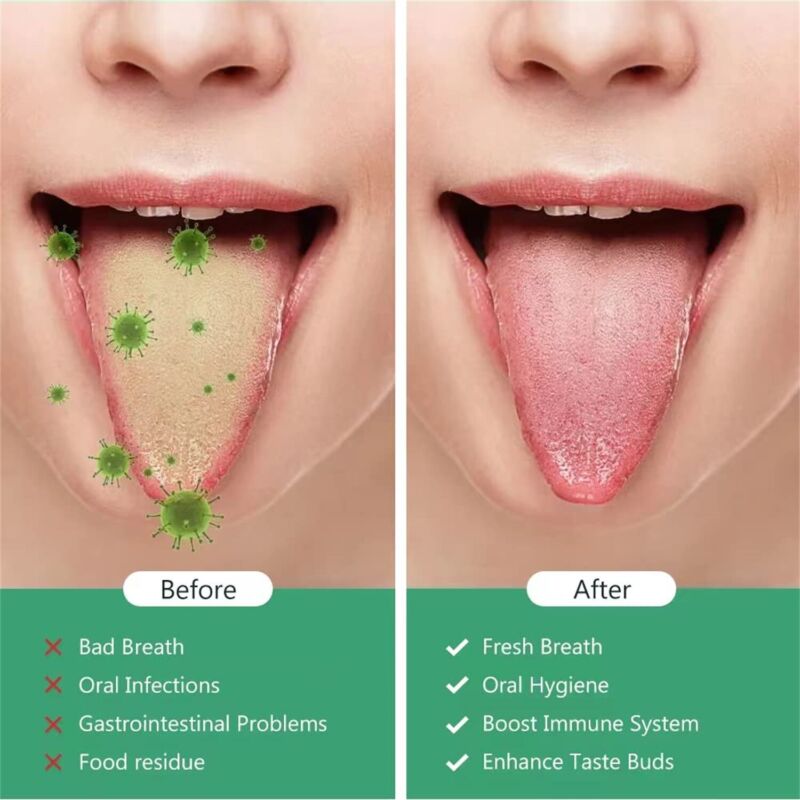 Tounge Cleaner Scraper Dental Care Oral Hygiene Mouth Kit Stainless Steel